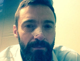 52434-hugh-jackman-j-aurai-plusieurs-cancers